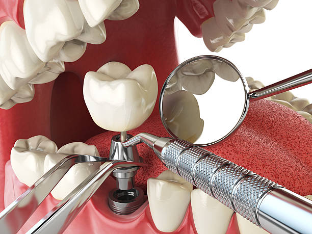 Best Cracked Tooth Emergency Dentist  in Deale, MD